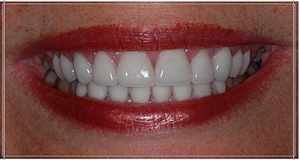Before dental work