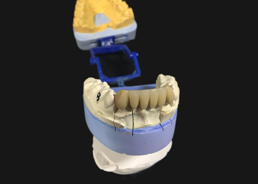 Before dental work