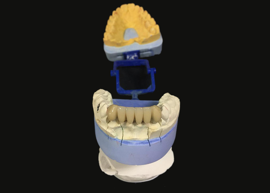 Before dental work