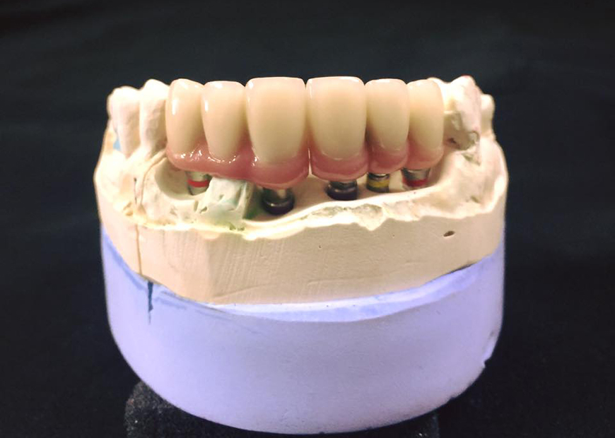 Before dental work