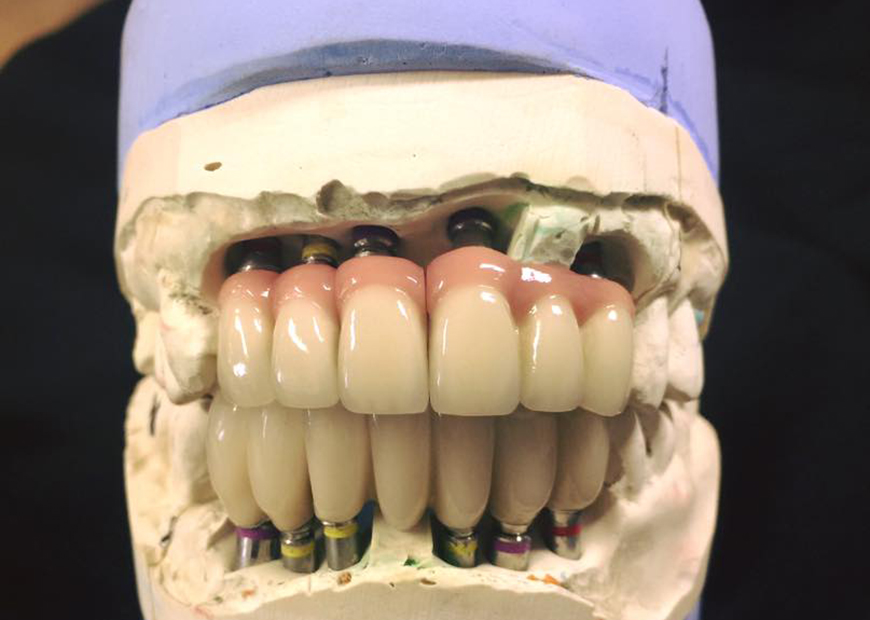 Before dental work