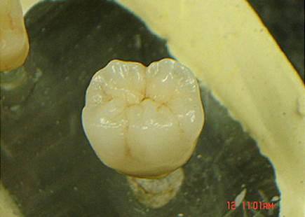 Before dental work