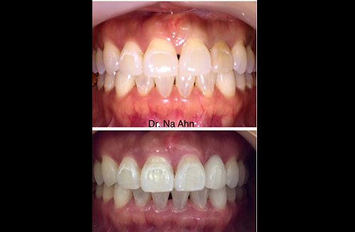 Foothill Dental Lab