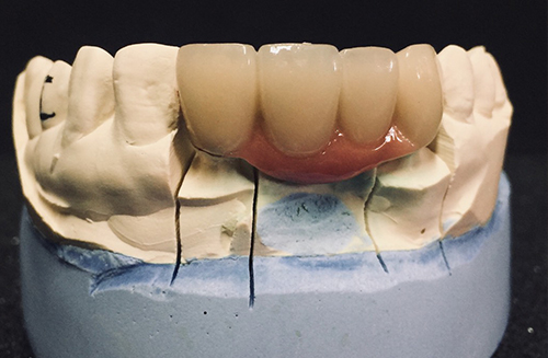 Foothill Dental Lab