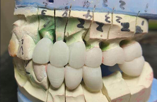 Foothill Dental Lab