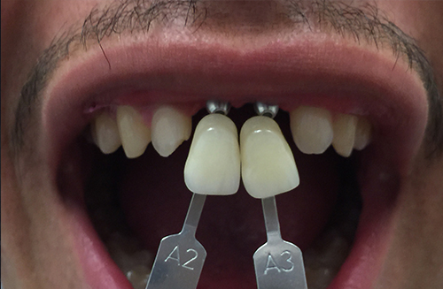 Foothill Dental Lab