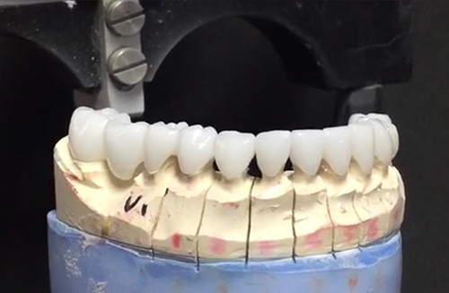Foothill Dental Lab