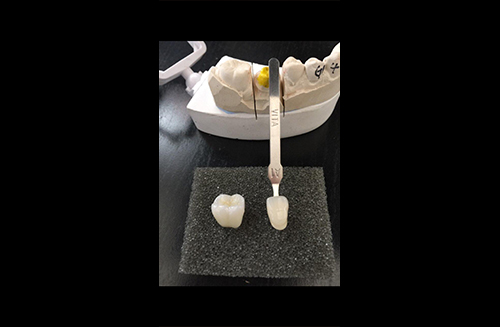 Foothill Dental Lab